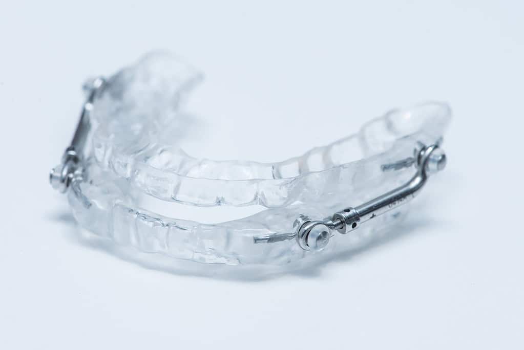 Die Zahnschienentherapie – die bessere Alternative zu CPAP? 1 Zahnschienentherapie