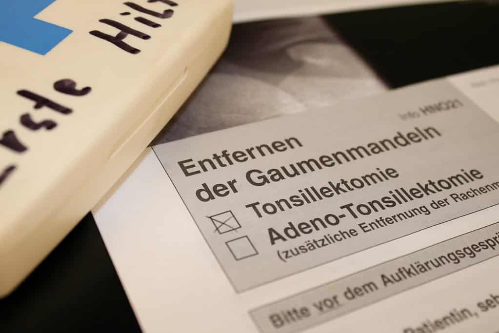 Kann eine Mandeloperation die Schlafapnoe heilen? 1 Mandeloperation bei Schlafapnoe