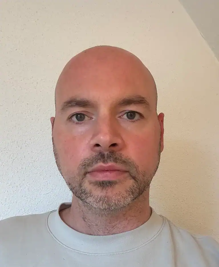 Erfahrungsberichte nach der Operation - Schlafapnoe heilen 1 Erfahrungsbericht - Schlafapnoe Operation - Sascha Wendt